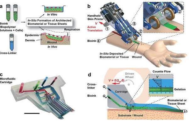 多伦多大学开发手持式皮肤3D打印机 用于快速修复深度伤口 小型 领域 改变 分裂 不良 便宜 便携 手持 打印机 打印 新闻资讯  第2张