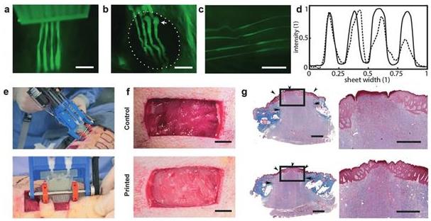 多伦多大学开发手持式皮肤3D打印机 用于快速修复深度伤口 小型 领域 改变 分裂 不良 便宜 便携 手持 打印机 打印 新闻资讯  第3张